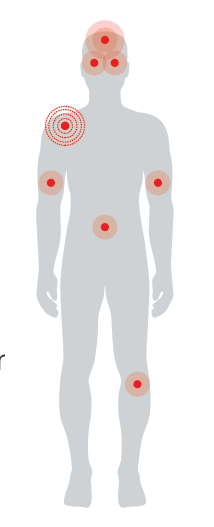 Esquema de síntomas